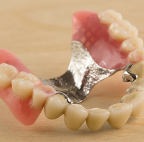Affordable Dentures with the Ultimate in Comfort and Beauty from Sparkle Dental in Warren, MI