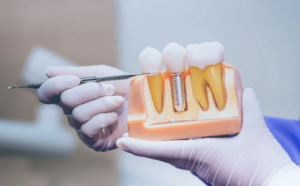 Images Parkway Family Dental