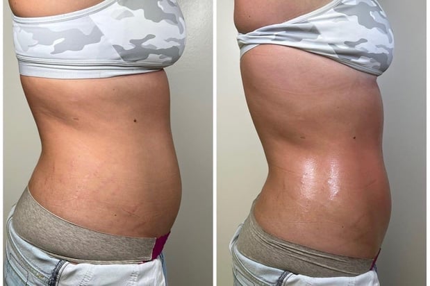 Images Permanent Makeup & Aesthetics in Maine