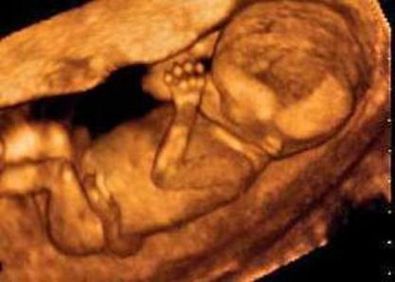 Images Fetal Memories 2D 3D 4D Ultrasound