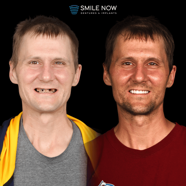 Images Smile Now Milwaukee Dentures and Implants