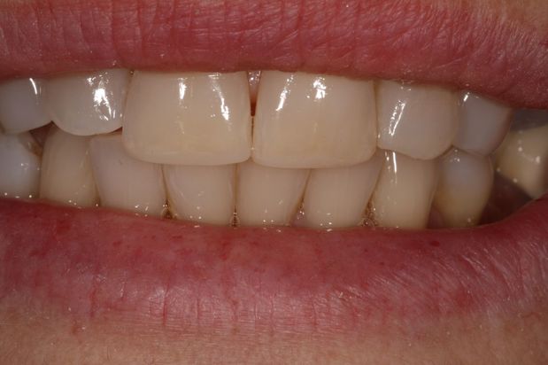 Images Aaron A. Leishman DMD, PA