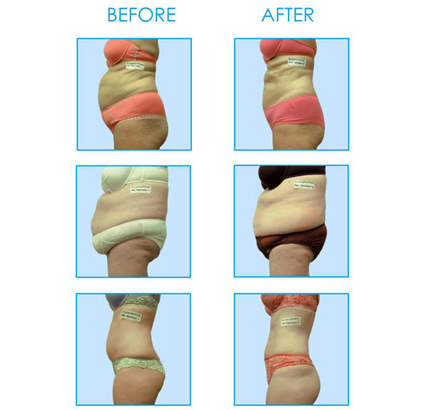 Images Annette R. Millie, MD- MATAAS