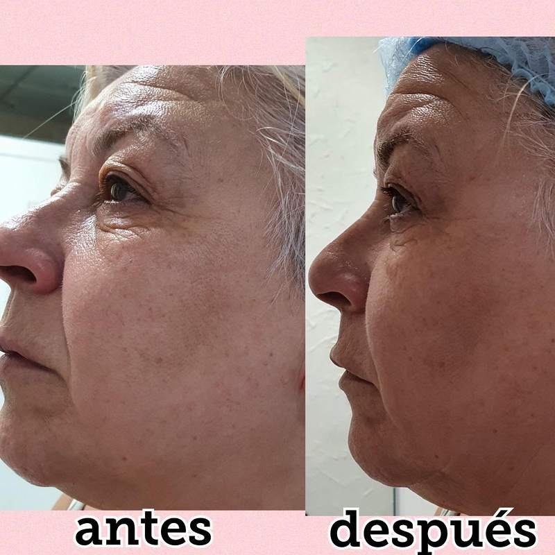 Images Centro De Estética Avanzada Y Láser Verónica Vico