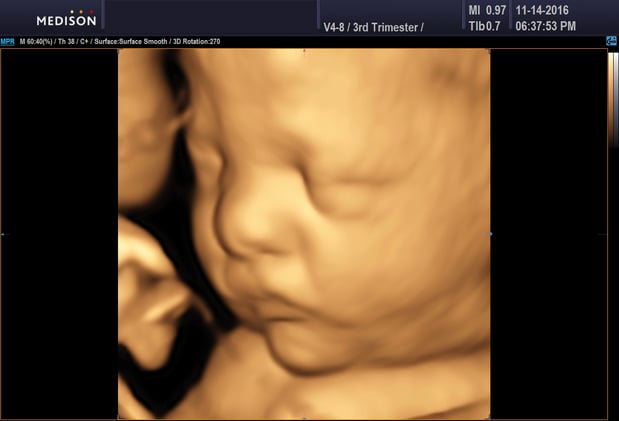 Images Heavenly 3D 4D Ultrasounds