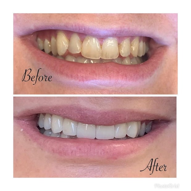 Images NorthStar Dental