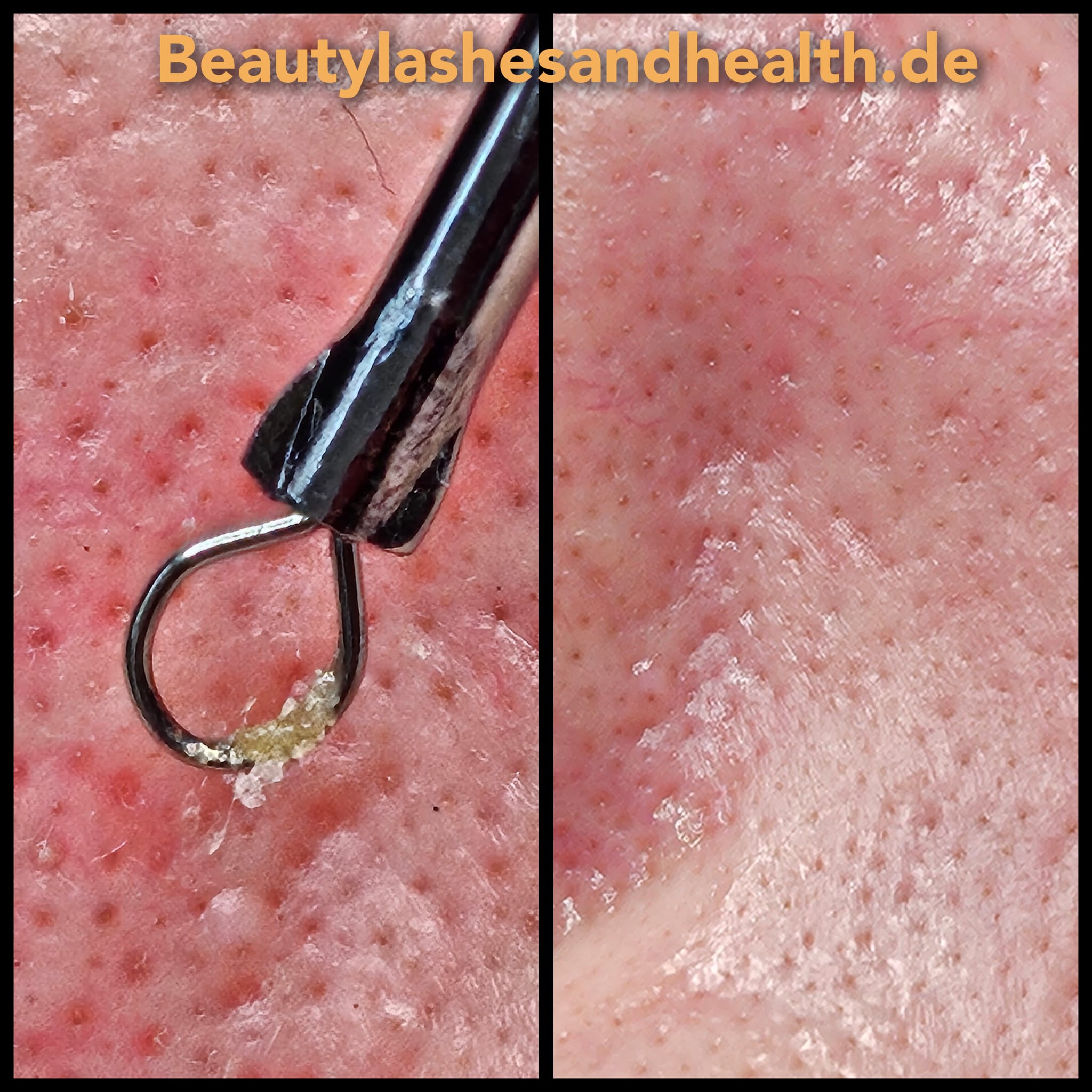 Beauty Lashes & Health, Heinestraße 18 in Reinsdorf