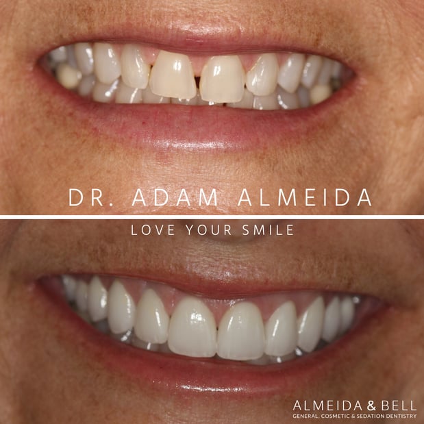 Images Almeida & Bell Dental Lone Tree - General, Cosmetic, and Implant Dentistry