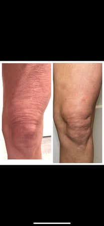 Images Body Lounge Park Cities - Whole Body Wellness & Medical Aesthetics, Dallas, TX