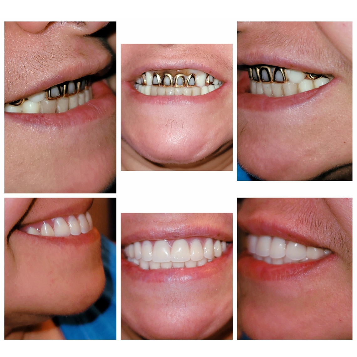 Marcos Torres Dental Esthetics- Tratamiento especial para La Sonrisa