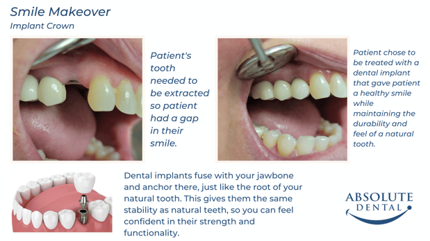 Images Absolute Dental
