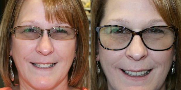 Images LaFayette Dental Associates