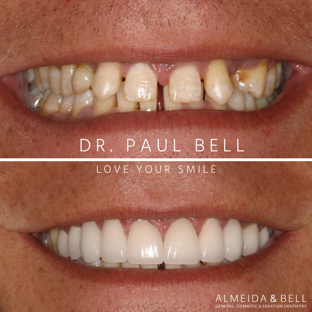 Images Almeida & Bell Dental Lone Tree - General, Cosmetic, and Implant Dentistry