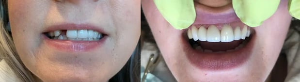 Images Twin Branch Dental