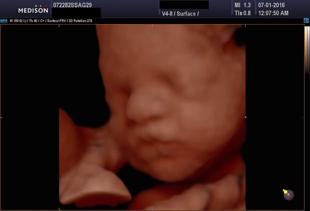 Images Heavenly 3D 4D Ultrasounds