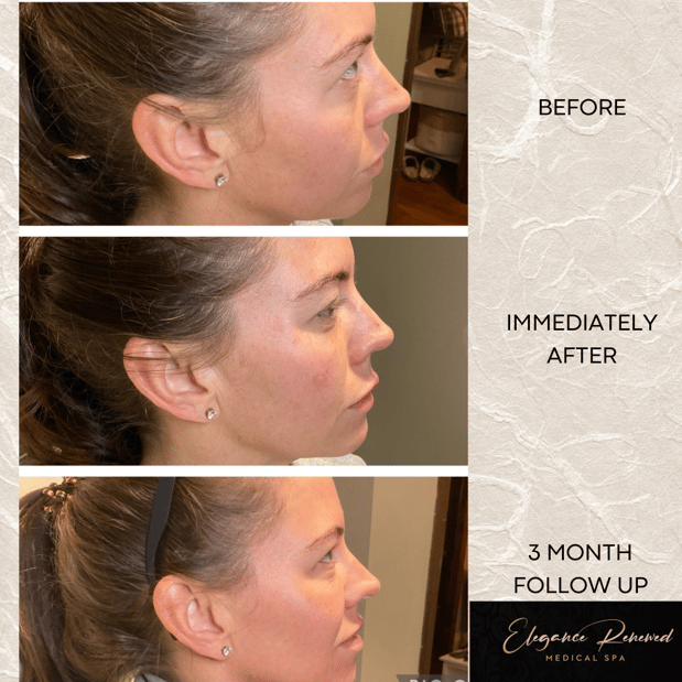 Images Elegance Renewed Medical Spa