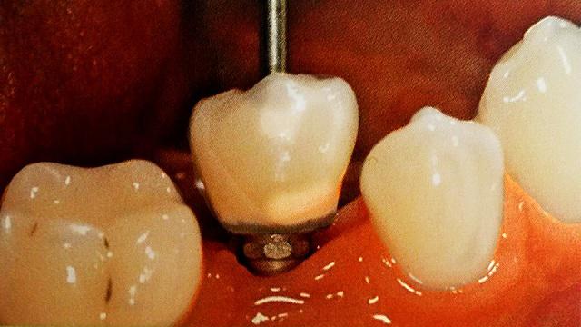 Images Clínica Dental El Quirinal