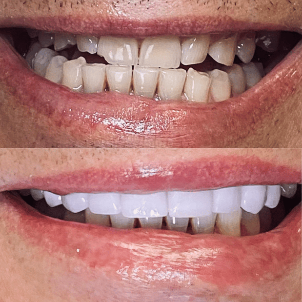 Images Selfie Smiles Dental Group