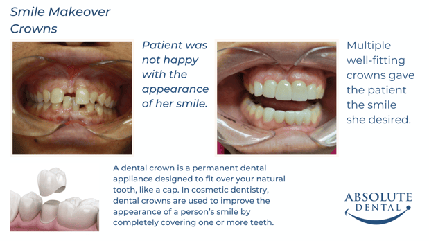 Images Absolute Dental