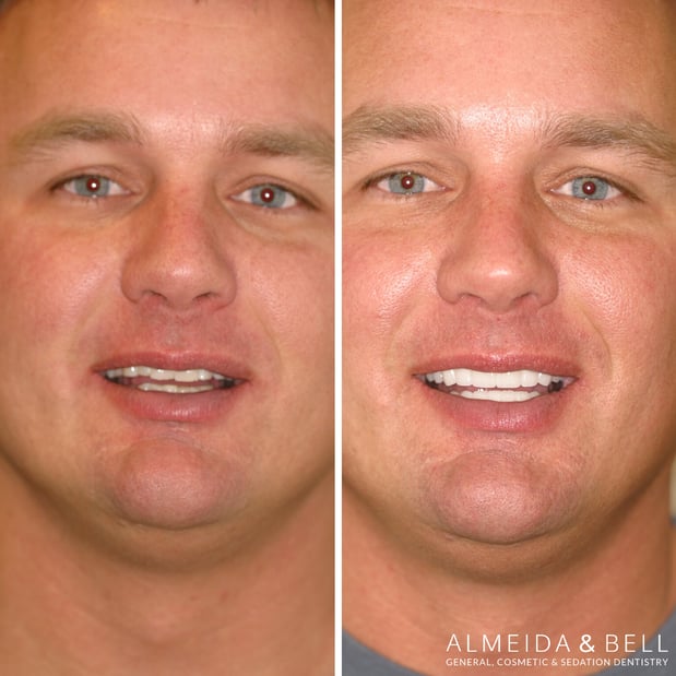 Images Almeida & Bell Dental Lone Tree - General, Cosmetic, and Implant Dentistry
