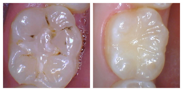 Images South Shreveport Dental