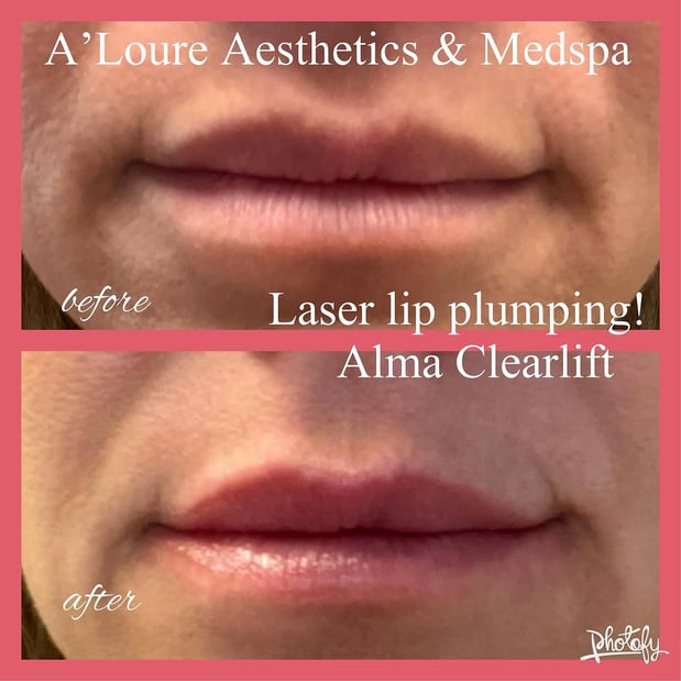 Images A'Loure Aesthetics and Medspa