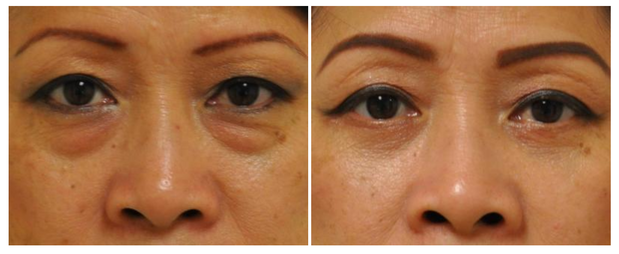 Images Newport Body: Richard H. Lee, MD