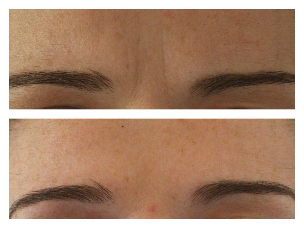 Images About Face Medical Aesthetics - Richmond