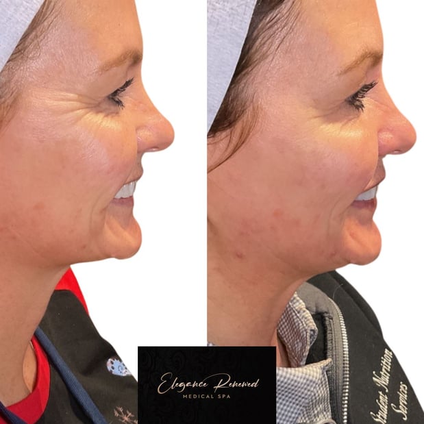 Images Elegance Renewed Medical Spa