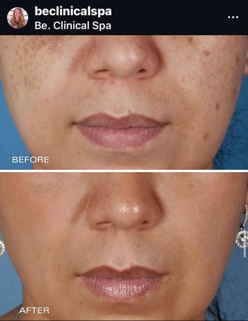 Images Be. Clinical Spa