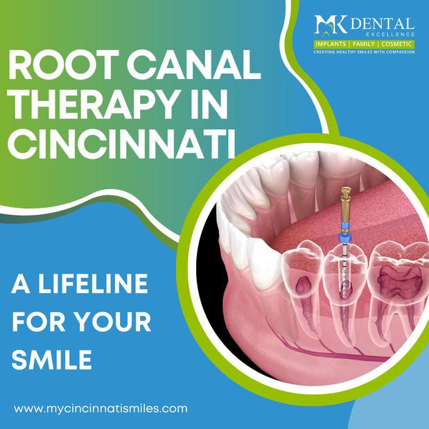 Images MK Dental Excellence – Dentist Cincinnati