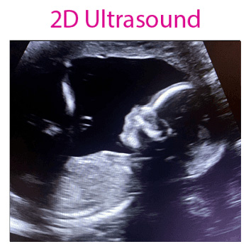 Images 4D Baby Ultrasound Studio