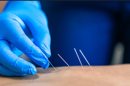 Images Fuel Sports Physical Therapy - Northbrook