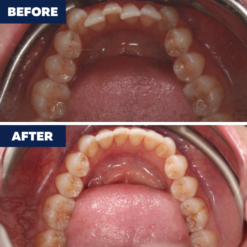 Images Orthodontics of Carson