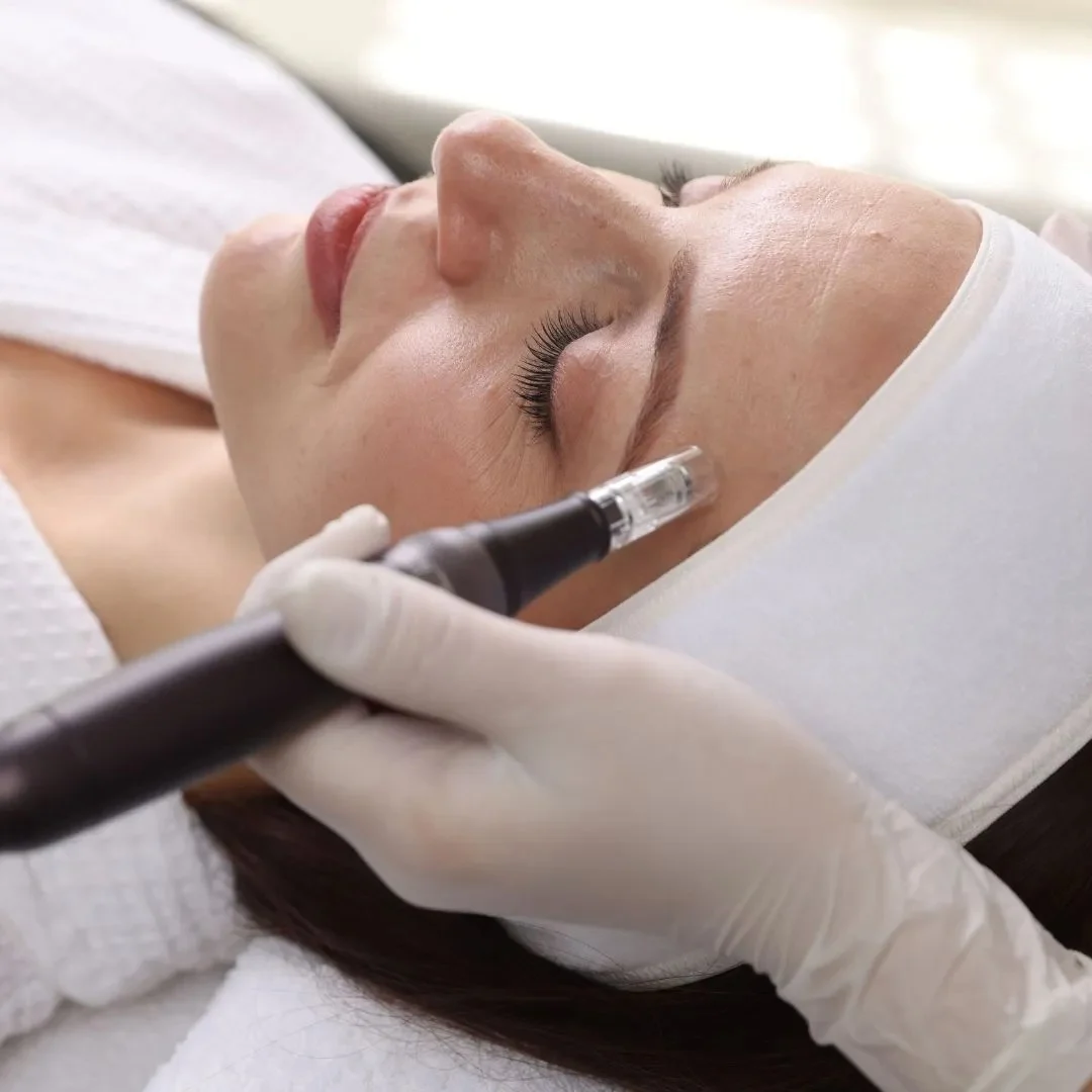 Microneedling – Stimulate Collagen for Smoother, Firmer Skin