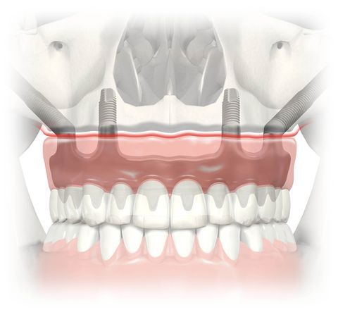 River Valley Advanced Dental & Implant Center Photo