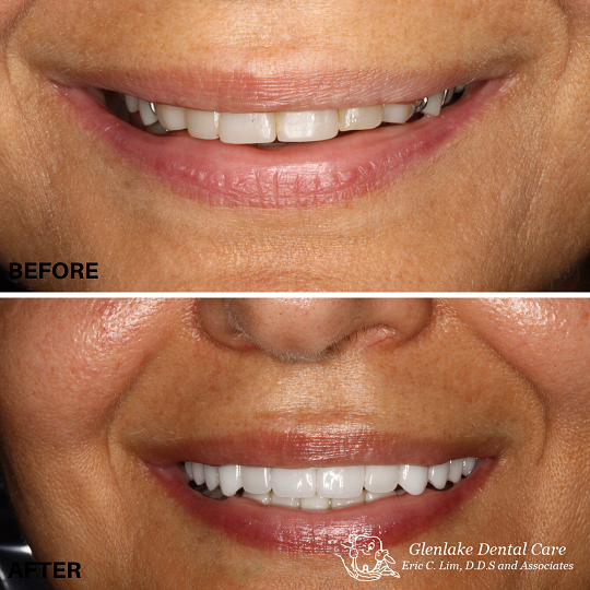 Images Glenlake Dental Care