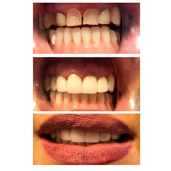 Cortes Family Dentistry-Cirugía Oral