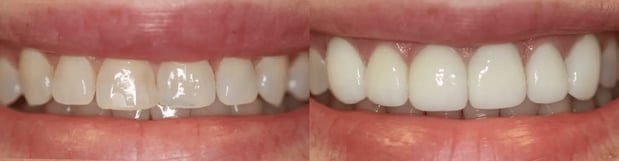 Images River Oak Dental