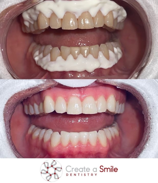 Images Create A Smile Dentistry - Dr. Ken Moore