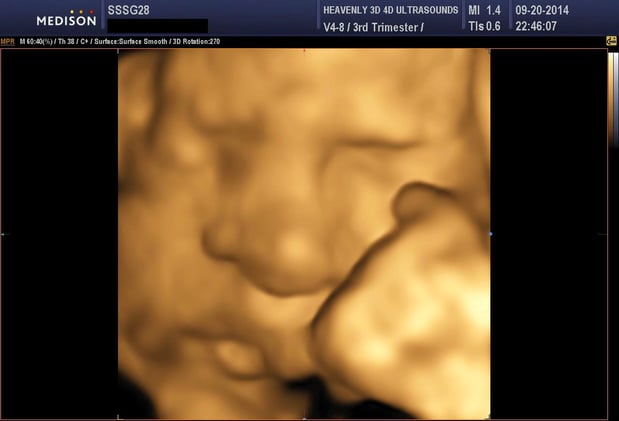Images Heavenly 3D 4D Ultrasounds-Upland