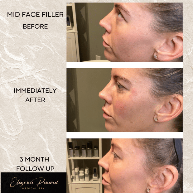 Images Elegance Renewed Medical Spa