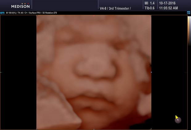 Images Heavenly 3D 4D Ultrasounds