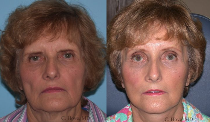 Images Hove Center for Facial Plastic Surgery