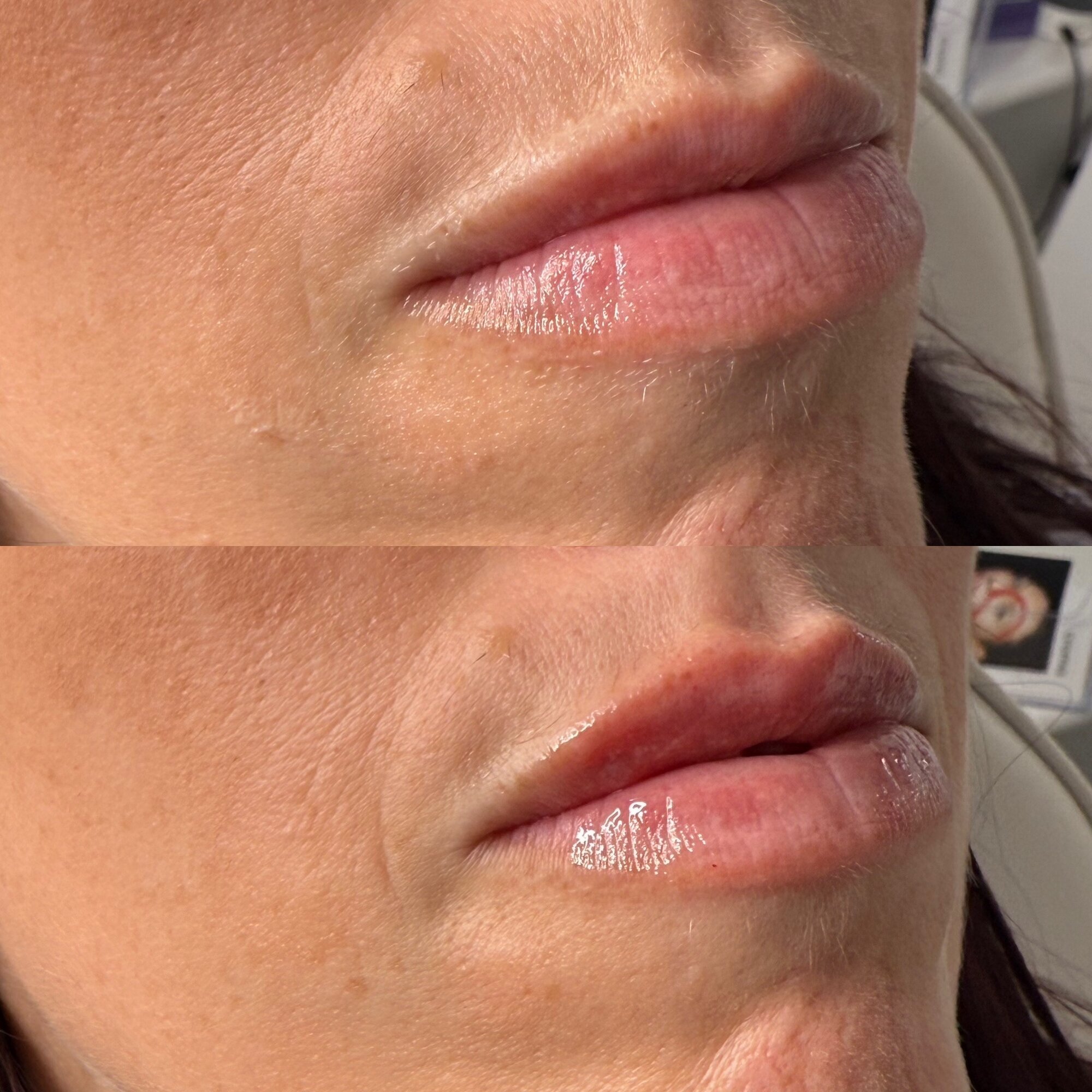 Images Harvey Medical Aesthetics