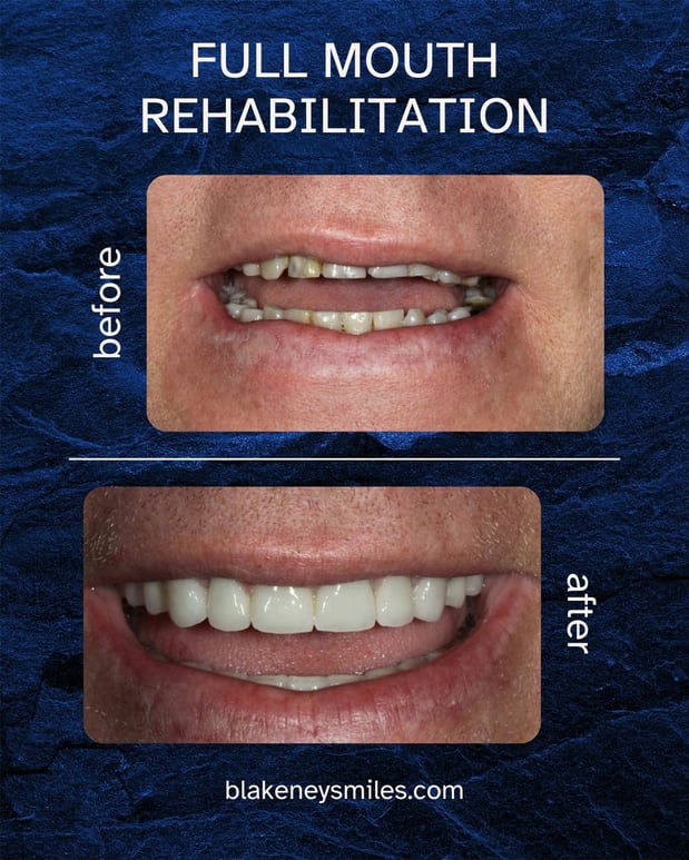 Images Advanced Dentistry of Blakeney