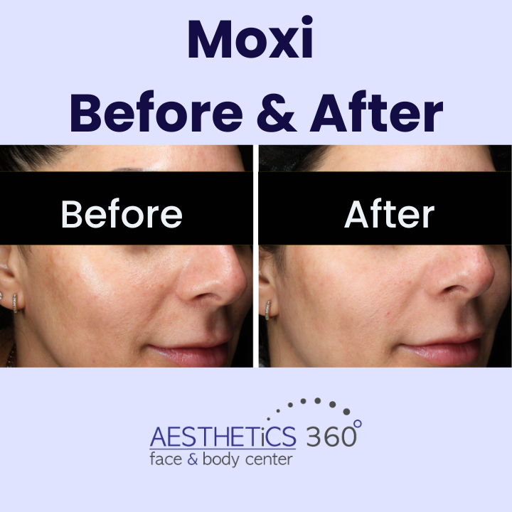 Images AESTHETICS 360° Face & Body Center