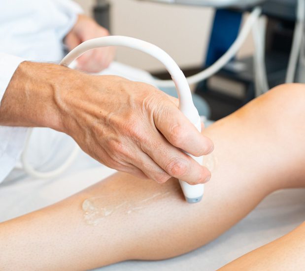 Images Gilvydis Vein Clinic