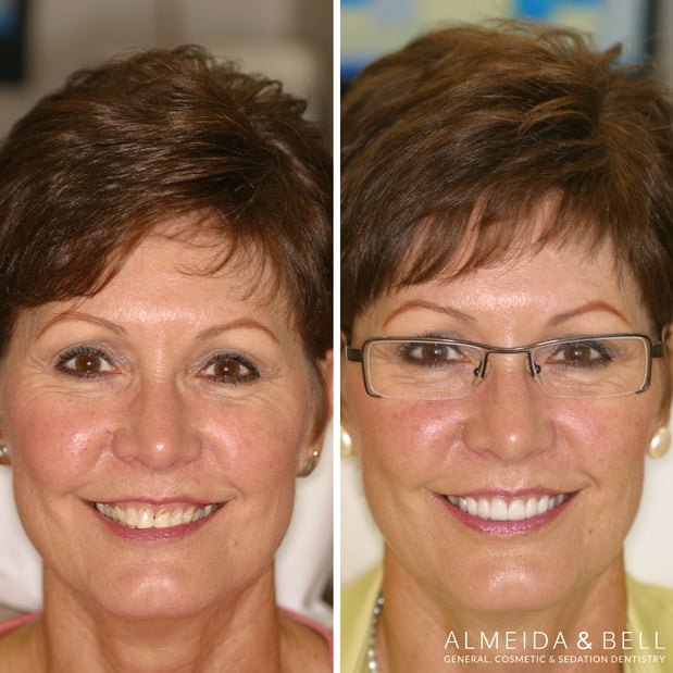 Images Almeida & Bell Dental Lone Tree - General, Cosmetic, and Implant Dentistry