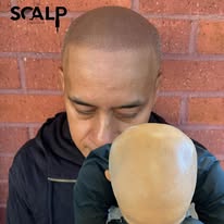 Images The Scalp Master